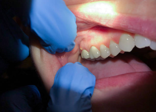 Best Emergency Orthodontic Repairs in Nett, MO