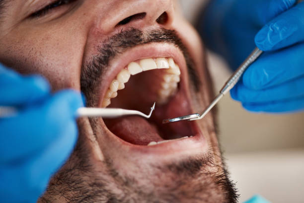 Best Emergency Broken Tooth Repair in Nett, MO